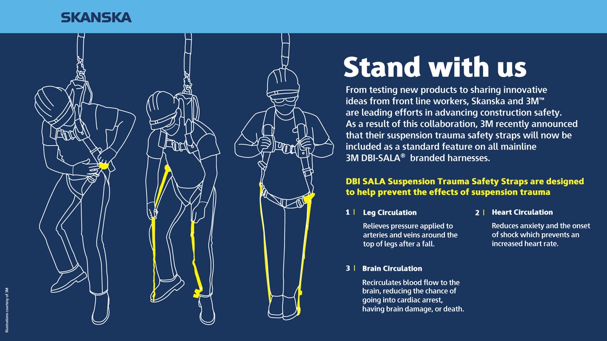 Suspension-Straps vs 2